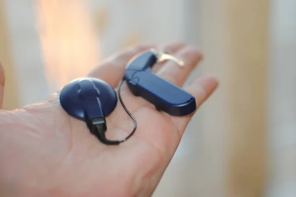 Кохлеарная имплантация — путь к миру звуков и речи