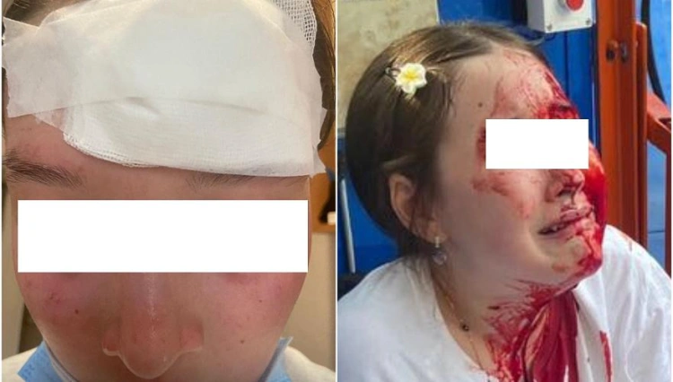 Девочка получила травмы на аттракционе в Алматы - возбуждено уголовное дело