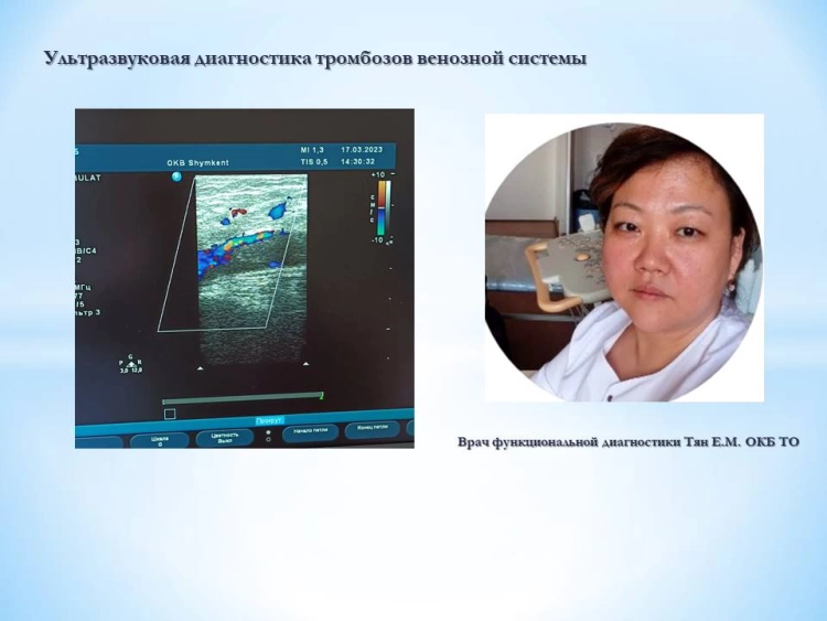 Ультразвуковая диагностика тромбозов венозной системы