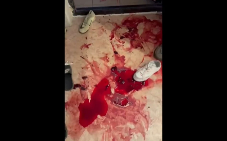 “Лёгкие повреждения” после насилия: адвокат добивается пересмотра экспертизы