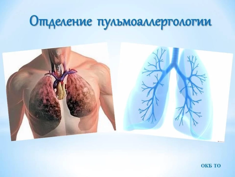 ОСМС: Идиопатический лёгочный фиброз