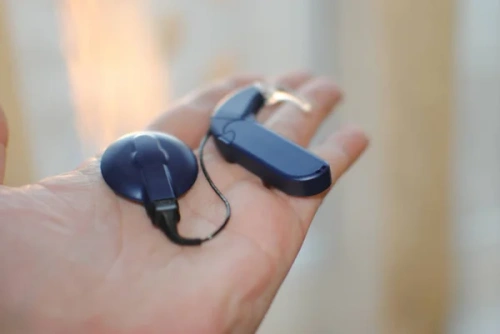 Кохлеарная имплантация — путь к миру звуков и речи